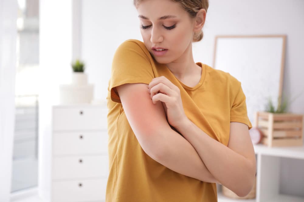 Woman scratching arm indoors